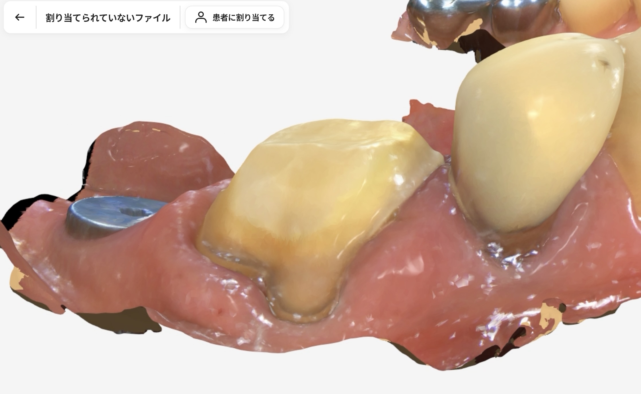 セレック